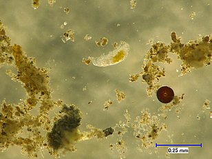 Bärtierchen (Tardigrada) - Winzige Überlebenskünstler, die extreme Umweltbedingungen überstehen und in grösseren Bodenporen leben – wichtige Bewohner im Mikrolebensraum Boden. Photo: Mailen Guerra Moreno (WSL)