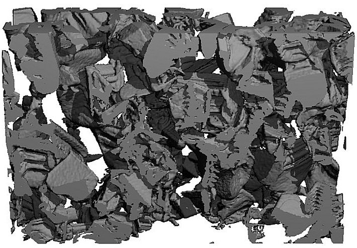 Becherartige Form (CT-Scan)