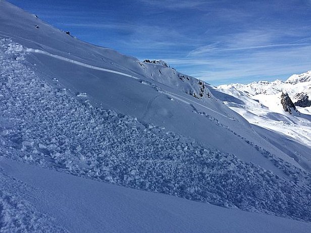 Abb. 5: Flächige, aber geringmächtige Schneebrettlawine, ausgelöst im eher windgeschützten Nordhang der Rätschenflue, Madrisa, GR auf 2200 m. Ob hier noch ein Oberflächenreif auf der Kruste lag? (Foto: C. Bless, 25.02.2017)
