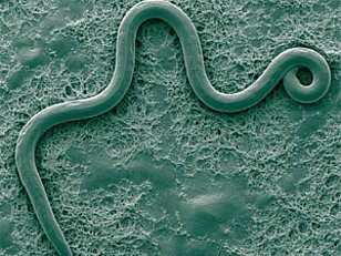 Fadenwürmer (Nematoda) - Häufigste vielzellige Tiere im Boden, mit vielseitigen Rollen: von Pflanzenparasiten bis zu Bakterienfressern – zentrale Akteure im Nährstoffkreislauf. Photo: Beat Frey (WSL)