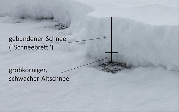 Abb. 8c: Erst im Nachhinein zeigt sich am Anriss der für eine Schneebrettlawine „perfekte“ Schichtaufbau: unten eine dünne Schicht aus stark aufgebauten, kantigen, grossen Kristallen als Schwachschicht. Darüber vielleicht 40 cm gebundener Schnee neueren Datums als „Schneebrett“ (alle Fotos: 08.02.2017).